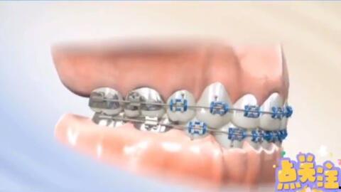 成人强直矫正神器图片视频,成人强直矫正神器革新体验-第2张图片-丝瓜视频成人