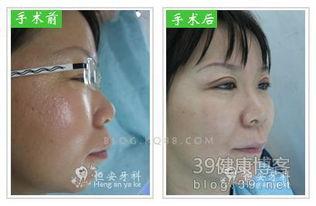 成人凸嘴矫正视频大全,成人凸嘴矫正视频大全精选攻略-第1张图片-丝瓜视频成人